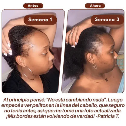 BatanaOil™ Tratamiento Capilar Aceite - Oferta 2X1